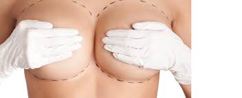 chirurgie esthétique des seins