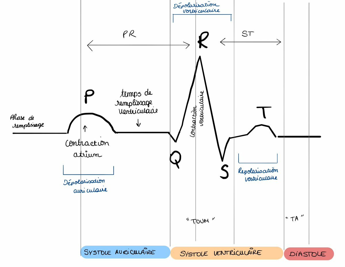 Cours n°2 - Electrocardiogramme (ECG) Ddx6