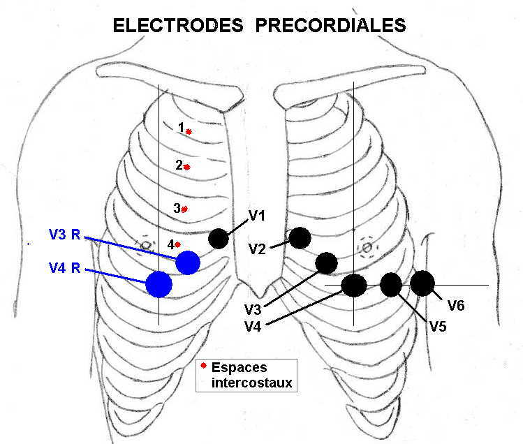 Cours n°2 - Electrocardiogramme (ECG) E0si