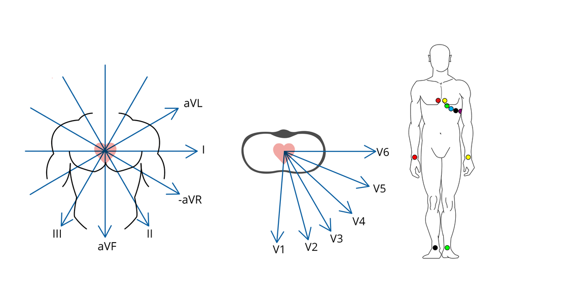 Cours n°2 - Electrocardiogramme (ECG) Ew83