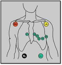 Cours n°2 - Electrocardiogramme (ECG) Kocg