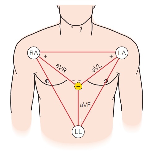 Cours n°2 - Electrocardiogramme (ECG) Lpzn